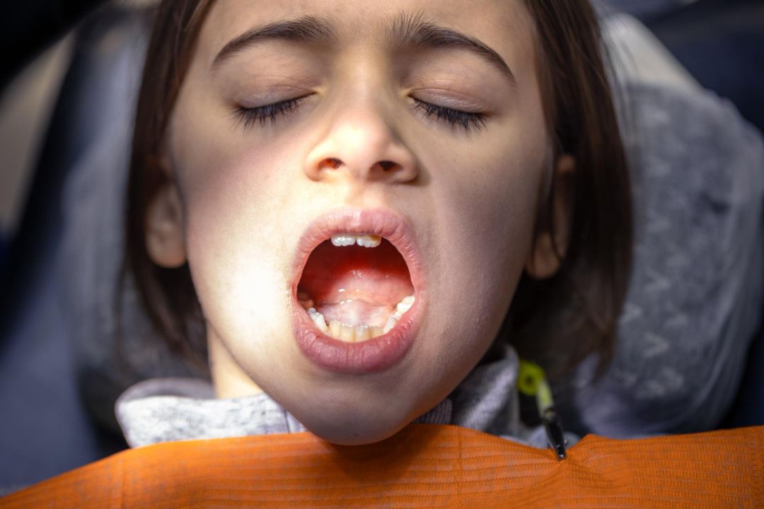 sleep apnea and kids oral health